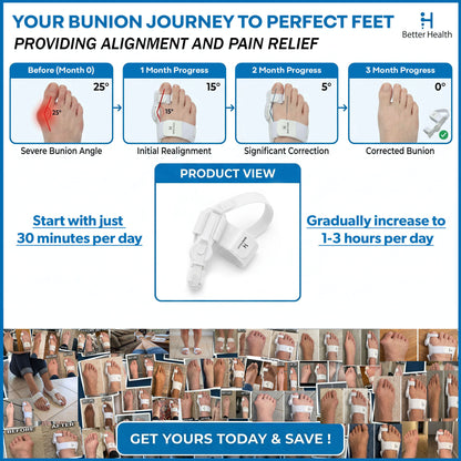 Bunion Corrector Fully Adjustable Women & Men Bunion Fix Big Toe Separator Day/Night Support Hallux Valgus (2PCS)