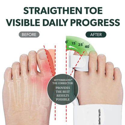 Adjustable Toe Corrector Separator For Women & Men